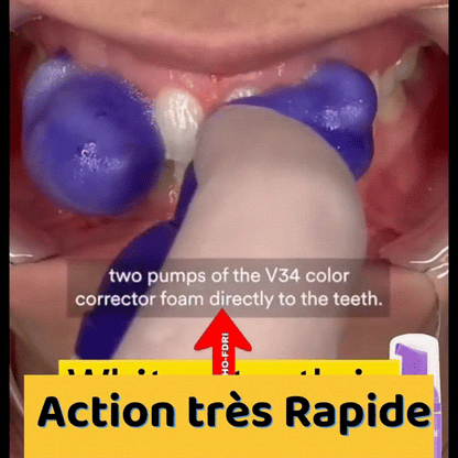 Smilekit Blanchisseur de Dent - V34